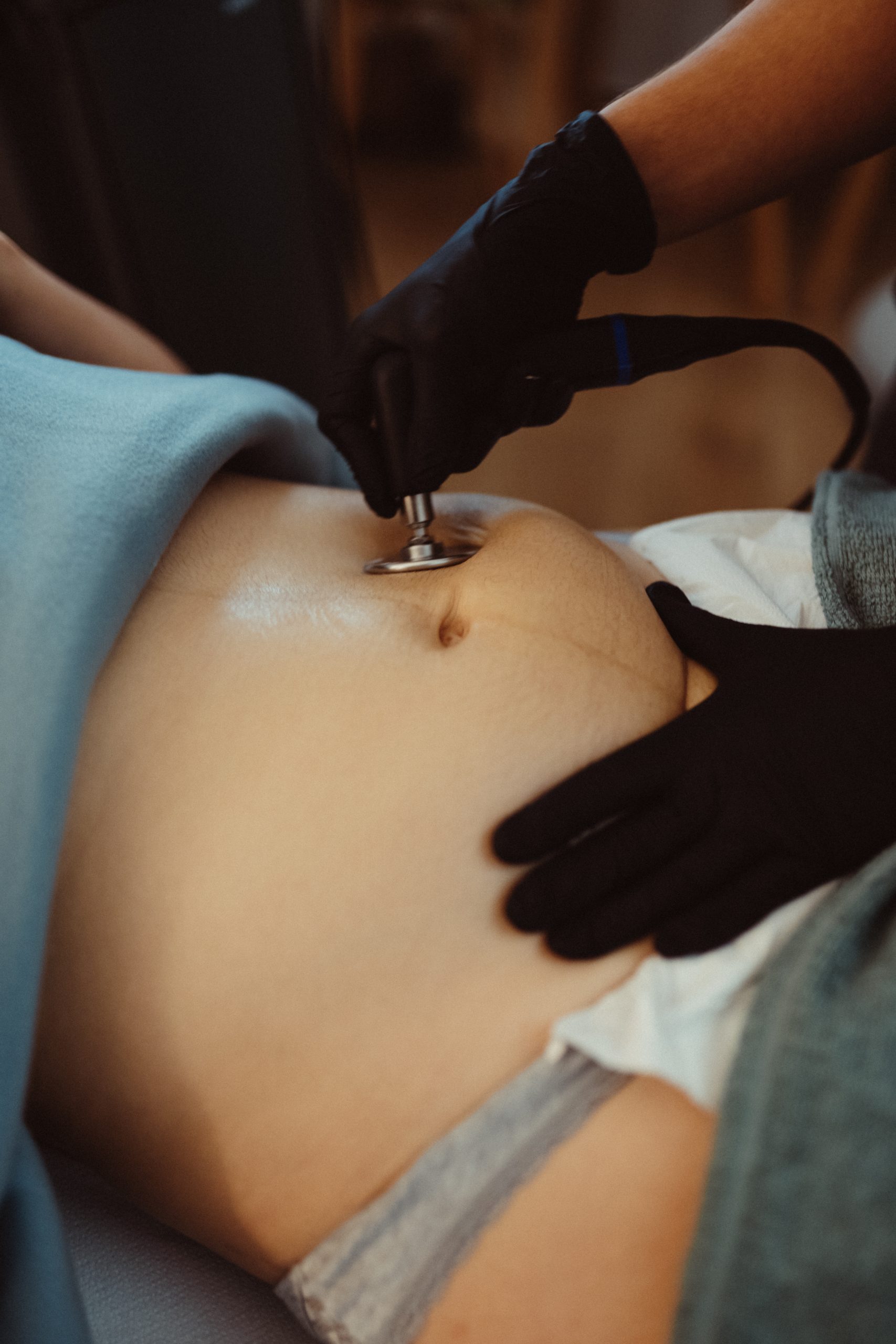 Aplicación de INDIBA en el abdomen en Clínica Althea, Badajoz